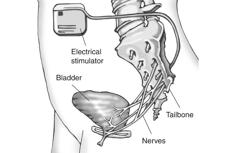 Parte baja del abdomen