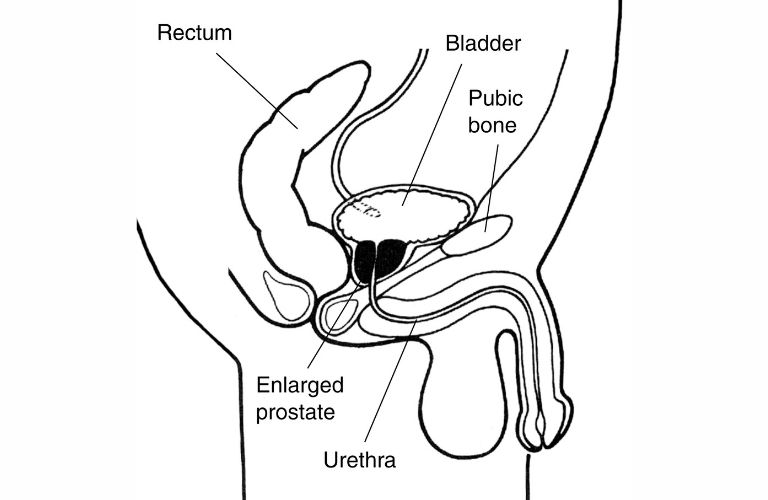 Prostate gland