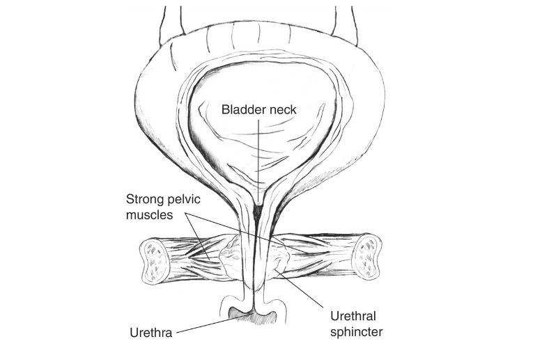 Urethral-stenosis overview