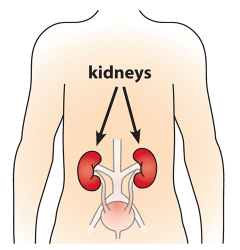 kidney-stone-mobile-hero-img-final